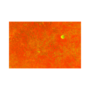 Kristel Schwede “Kas ühest piisab?”